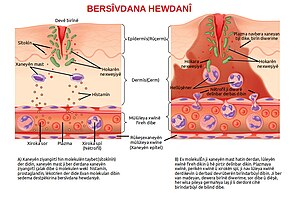 Bergiriya Giştî: Berbestên rûyî, Bergiriya xaneyî, Hellûşîn