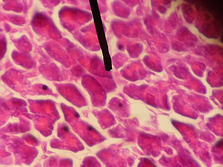 Acinar cells.JPG