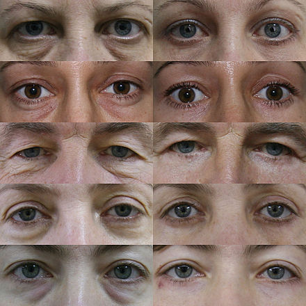 Виды век. Глаз в разрезе. Разный разрез глаз. Разные виды глаз. Различные формы глаз.