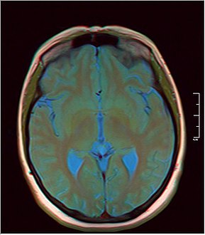 MRI axial in false color