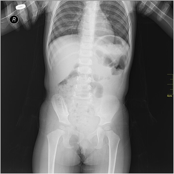 File:Medical X-Ray imaging QUJ06 nevit.jpg