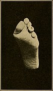 Category:Practical podiatry (1918) - Wikimedia Commons