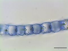 19.12.12 Sphagnum magellanicum