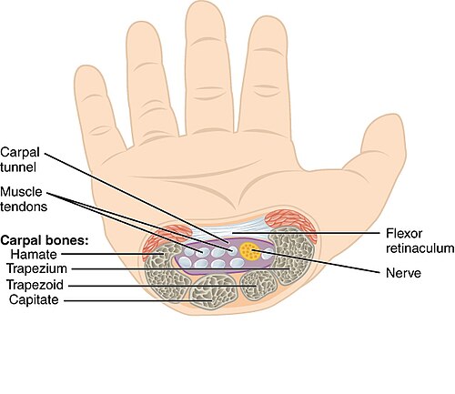 Carpal Tunnel Wikiwand