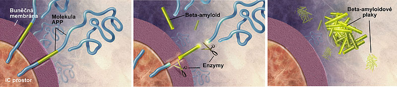 File:Amyloid-plaque formation-cs.jpg