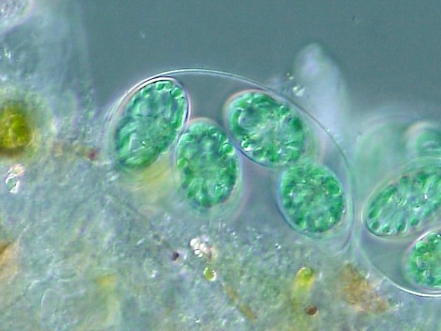 The chloroplasts of glaucophytes like this Glaucocystis have a peptidoglycan layer, evidence of their endosymbiotic origin from cyanobacteria.