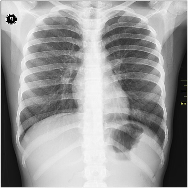 File:Medical X-Ray imaging QII06 nevit.jpg