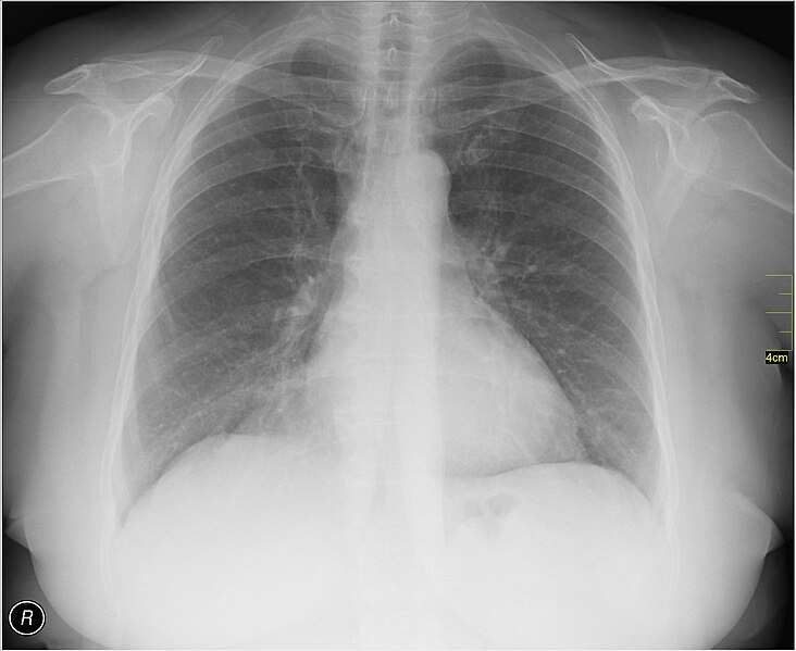File:Medical X-Ray imaging SSE07 nevit.jpg