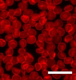 Human red blood cells viewed through a microscope. The cell membrane has been stained with a fluorescent dye. Scale bar is 20 mm. Sedimented red blood cells.jpg