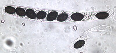 Sordaria fimicola ascus plus ascospore Sordaria fimicola ascus plus ascospore.jpg