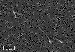 Spermatozoa-human-3140x.jpg