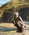 "A mutilated victim of Wemba savagery, Livingstonia", ca.1910 (imp-cswc-GB-237-CSWC47-LS4-1-020) (cropped).jpg