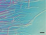 Hyhpae of Geotrichum candidum. Scale bar = 10 µm.