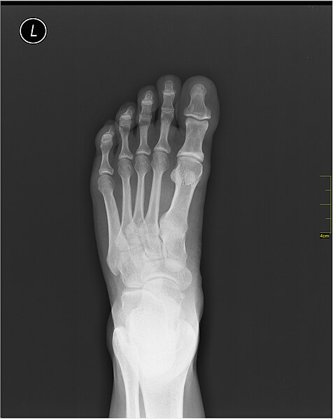 File:Medical X-Ray imaging VXV07 nevit.jpg