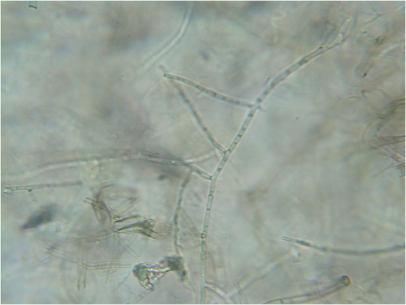 File:Rhizoctonia hyphae 160X.png