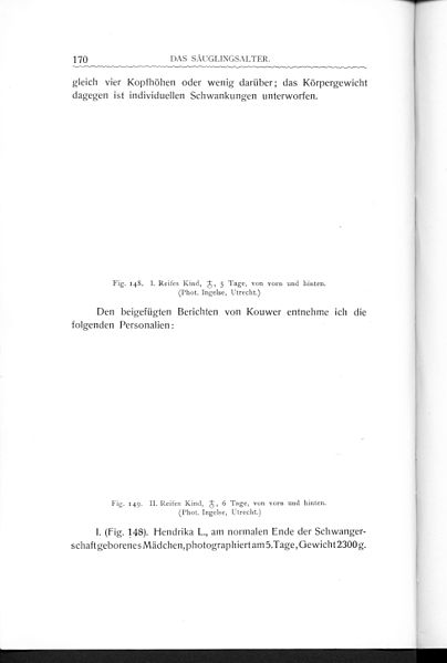 File:Stratz Körper des Kindes 3 170.jpg