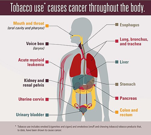 Tobacco-use-causes-cancer.jpg