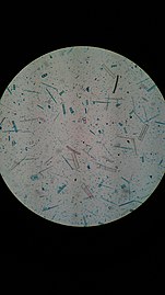 various diatoms