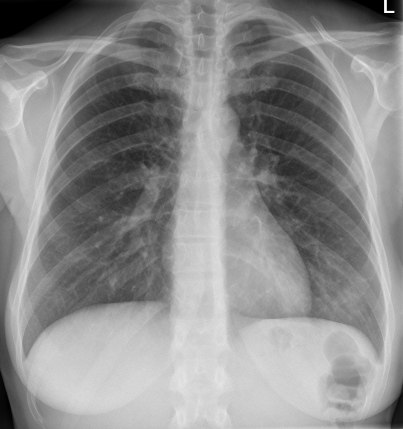 Esitellä 33+ imagen röntgenkuvaus tulokset