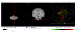 Allen Brain tissue expression.tiff