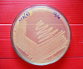 E.coli khi nuôi cấy trên đĩa pêtri.