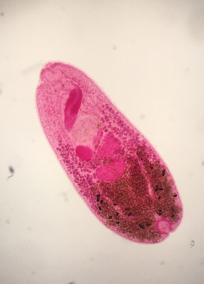 Трематоды у человека фото