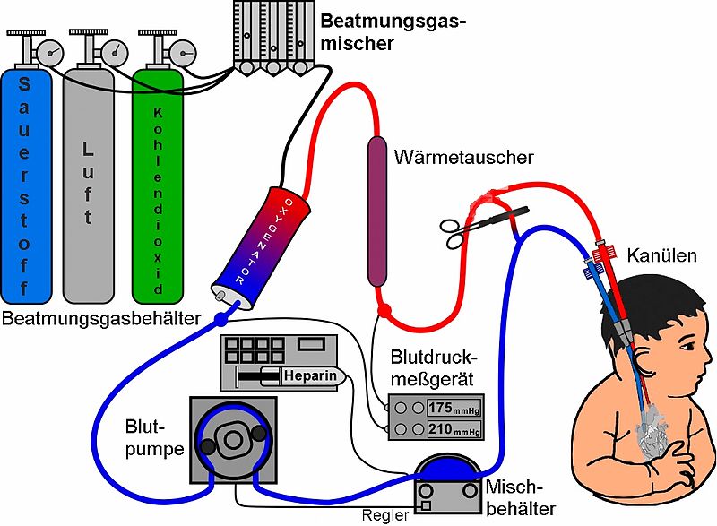 File:Ecmo schema-1-de.jpg