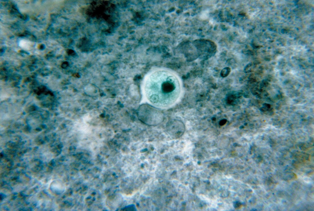 Entamoeba