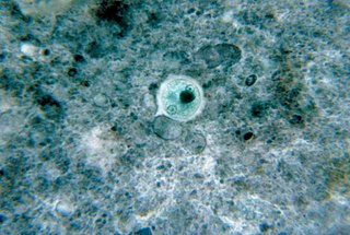 Microbial cyst Resting or dormant stage of a microorganism