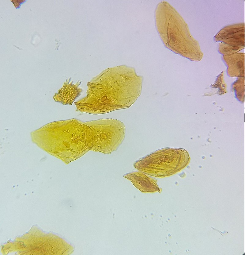 cheek cells 400x