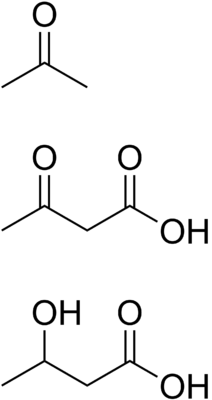 Химическая структура трёх кетоновых тел: ацетон, ацетоуксусная, и бета-оксимаслянная кислоты[1].