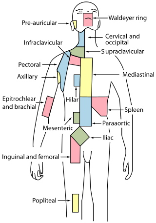 <span class="mw-page-title-main">Waldeyer's tonsillar ring</span> A ringed arrangement of lymphoid tissue in the pharynx.