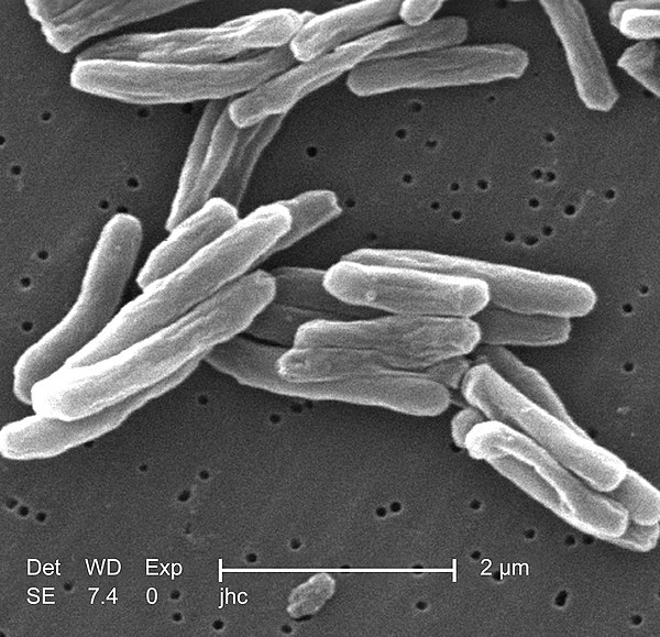 Scanning electron micrograph of Mycobacterium tuberculosis, a species of pathogenic bacteria that cause tuberculosis