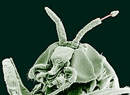 Onchocerca volvulus emerging from a blackfly Onchocerca volvulus emerging from a black fly.jpg