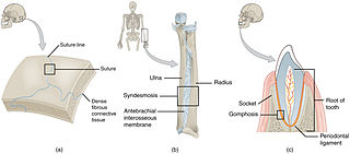 <span class="mw-page-title-main">Fibrous joint</span> Fixed joints between bones held together by dense, fibrous tissue