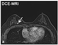 File:Comparison of comorbidities for primary breast cancer by ethnicity  (A), and asthma by sex (B).jpg - Wikipedia