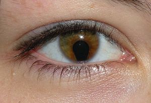 Colobom cu disc optic: cauze și tratament - Inflamaţie 