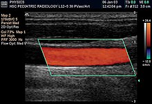 Doppler ultrasonography - Wikipedia