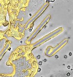 Fil: Electron-Tomography-Reveals-the-Steps-in-Filovirus-Budding-ppat.1000875.s001.ogv