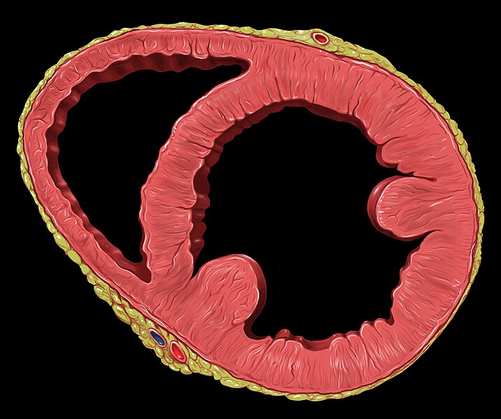 File:Heart global dysfunction sa.jpg