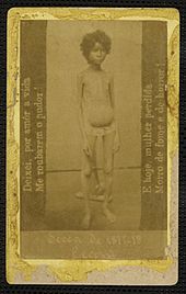 Malnourished child during Brazil's 1877-78 Grande Seca (Great Drought). Icon1 4 7.jpg