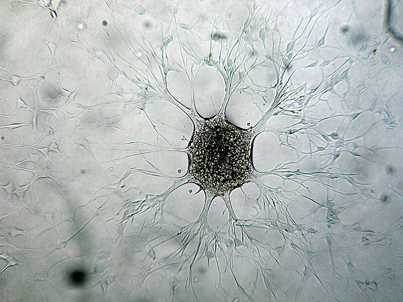 File:Immagine di cellula di Glioblastoma multiforme della mia linea cellulare patentata presso ECACC ANGMCSS.jpg