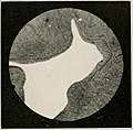 Interpretation of dental and maxillary roentgenograms (1918) (14571564328).jpg