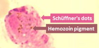 Thumbnail for File:Microphotograph of Plasmodium ovale microgametocyte in Giemsa-stained thin blood film, with Schüffner's dots and hemozoin pigment.png