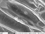 在洋葱片内表面的表皮细胞。在shagreen样细胞壁下面，可以看到细胞核和漂浮在细胞质中的小细胞器。镧系染色样品的BSE图像在没有预先固定，脱水或溅射的情况下拍摄。
