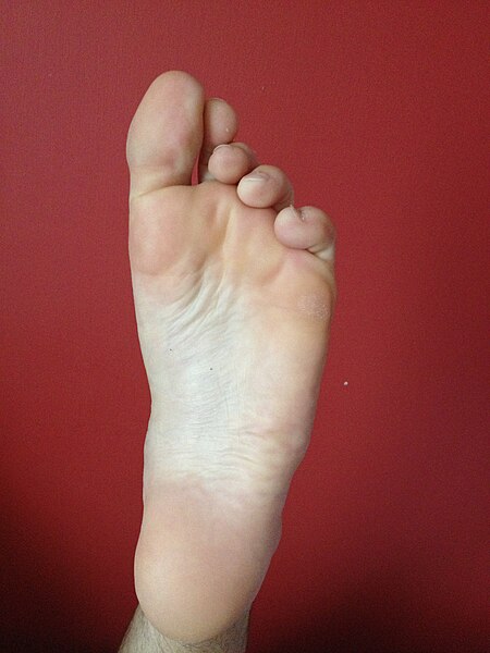 File:Sole of left foot Caucasion.JPG