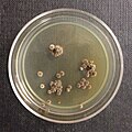 Wallemia sebi (klassen Wallemiomycetes) er en encellet gærsvamp, der her danner kolonier på fast medium i en Petriskål.