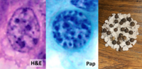 Thumbnail for Salt-and-pepper chromatin