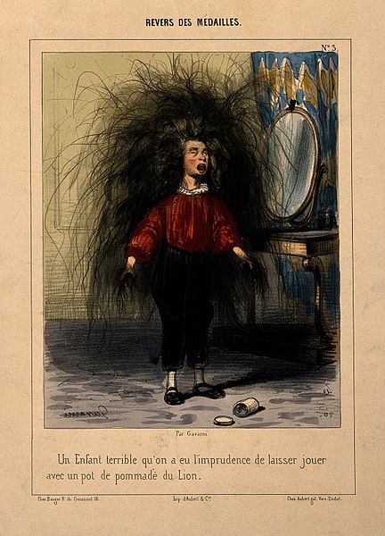 File:A boy with incredibly long hair growing from his head and ha Wellcome V0007417.jpg