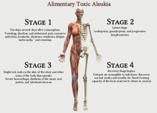 <span class="mw-page-title-main">Alimentary toxic aleukia</span> Medical condition